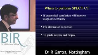 Current Status and Future Directions of SPECT/CT Imaging: Image Fusion and Clinical Utility