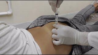 The Secret to Painless Intramuscular Injections in the Bottom