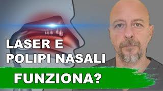 Intervento LASER e POLIPI nasali: FUNZIONA?