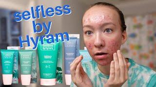 i tried HYRAM's skincare line... is it worth it?? (selfless by hyram)