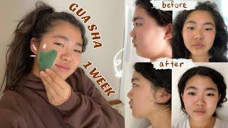 GUA SHA Before and After——1 WEEK of gua sha massage