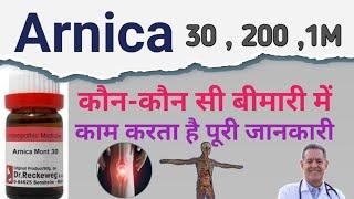 Arnica Ke Fadey / Arnica 30 homoeopathic Medicine Uses in Hindi / Arnica 200