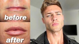 How To Get Bigger More Attractive Lips (for guys)