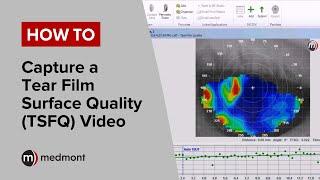 How To | Capture a Tear Film Surface Quality video (Studio 6.1)