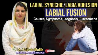 What is Labial synechie | Symptoms and Solution of labia adhesion | labial fusion kia he?