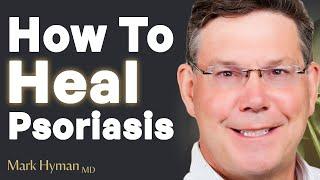 DO THIS To Heal Your Psoriasis TODAY! | Dr. Todd LePine & Mark Hyman