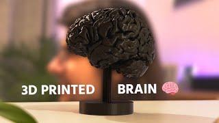 From MRI to 3D Print: My brain in plastic