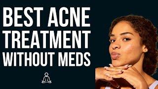 Best Laser Treatment for Acne in OC without Meds -NeoClear by Aerolase |  Dr. Robert Milanes, MD