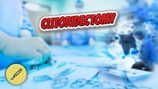 Clitoridectomy - Everything Surgeries ⁉️