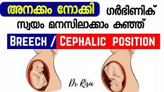 Cephalic vs Breech Baby Movement | Baby Head Down Symptoms |Pregnancy Baby Movement