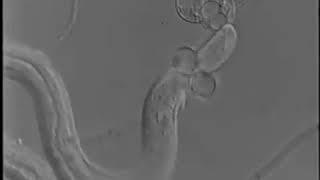 Nematode trapping fungi - Microscopic view