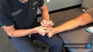 Foot Pain Treatment