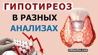 ГипоТиреоз нарушает показатели: холестерин, триглицериды, общий анализ крови, пролактин, тестостерон