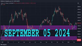 NASDAQ 100 Analysis Today | NAS100 Technical Analysis | NAS100 Analysis | NASDAQ 100 Daily Forecast