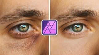 How to Remove Dark Circles in Affinity Photo