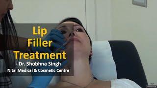  Lip Filler Treatment Melbourne | Nitai Medical & Cosmetic Centre (03) 9300 1244