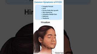 pcos symptoms #devpaltips #irregular #fertilizer #video #trading #viral #youtubeshorts