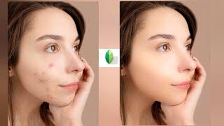 How to remove pimples and smooth Skin in snapseed tutorial || remove acne in snapseed editing