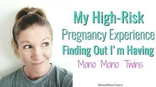 My High-Risk Pregnancy Experience - Finding Out I'm Having MoMo Twins