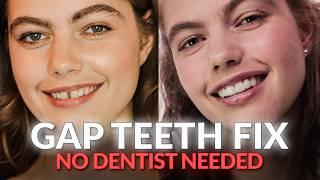 Stop Gap Teeth Embarrassment: Transform Your Smile NOW!