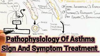 Pathophysiology Of Asthma Sign And Symptom Treatment @umerfarooqbiology7083