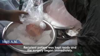 Heart ( Cardiac ) Transplant Surgery : Complete story of frozen heart coming to life : CIMS Hospital