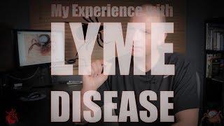 Lyme Disease from Ticks - My Experience after a Tick Bite
