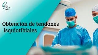 Obtención de tendones isquiotibiales