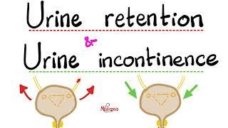 Urinary Incontinence- Stress Incontinence, Urge Incontinence, Overflow Incontinence, Urine Retention