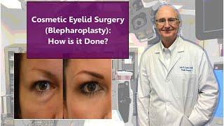 Cosmetic Eyelid Surgery (Blepharoplasty): How is it Done?