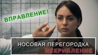 Искривление носовой перегородки, перелом и вправление носа.