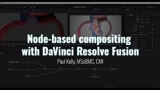 Node-based Compositing for Surgical Animation with DaVinci Resolve’s Fusion | TVASurg