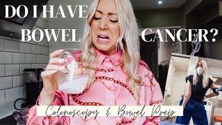 CHECKING FOR GENETIC BOWEL CANCER...MY COLONOSCOPY + PREP VLOG EXPERIENCE // SJ STRUM