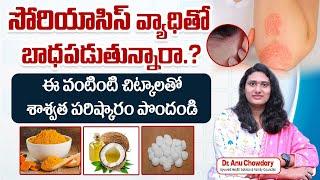 సోరియాసిస్ వ్యాధికి పరిష్కారం | Best Home Remedies for Psoriasis in Telugu | Socialpost Health