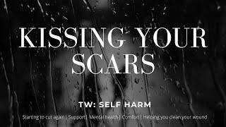 ASMR| Kissing Your Scars [TW: Self Harm][Comforting You] [Cleaning Your Wound][Girlfriend Roleplay]