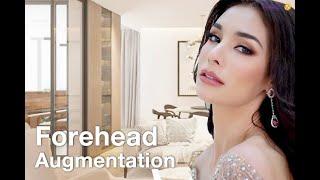 Miss Grand Thailand 2019 make a big decision with her forehead!