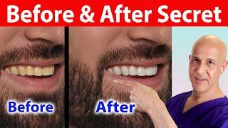 This Secret Fruit Whitens Teeth Instantly—You’ll Be Amazed!  Dr. Mandell