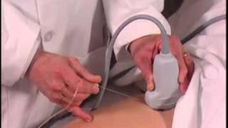 How To: Ultrasound Guided Hip Injection Scanning Technique Video