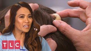 Lisa Has a "Horn" Coming Out of Her Head | Dr. Pimple Popper