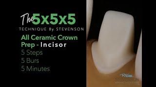 5x5x5 All Ceramic Incisor - Tooth Preparation for Maxillary Central Incisor