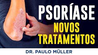 Psoríase – Novidades no Tratamento (2024) – Dr. Paulo Müller Dermatologista.