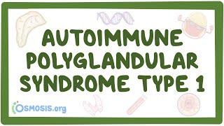 Autoimmune polyglandular syndrome type 1