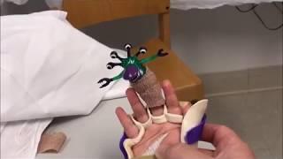 Paediatric hand transplant recipient in action