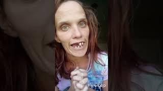 Crackheads of Tiktok Compilation #3