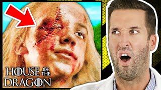 ER Doctor REACTS to House of the Dragon Injuries