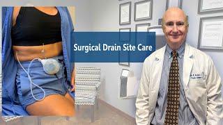 Surgical Drain Site Care