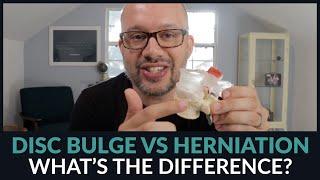 The Difference Between a Spinal Disc Bulge and Herniation