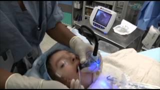 GlideScope Pediatric Airway Rounds Case Study: 4 year-old, Goldenhar Syndrome