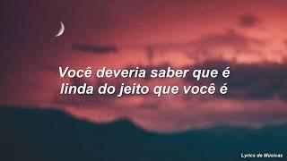 Alessia Cara - Scars To Your Beautiful (Tradução)