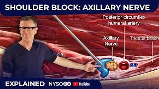 Shoulder Block: Axillary Nerve